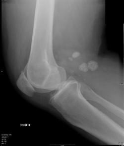 knee-radiology